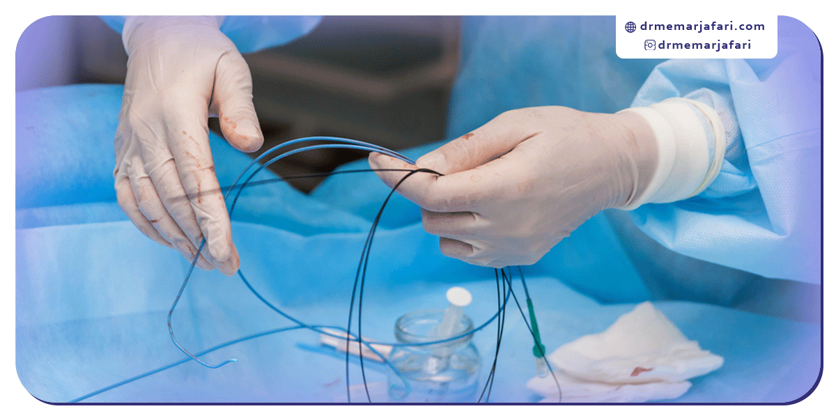 عوارض آنژیوپلاستی