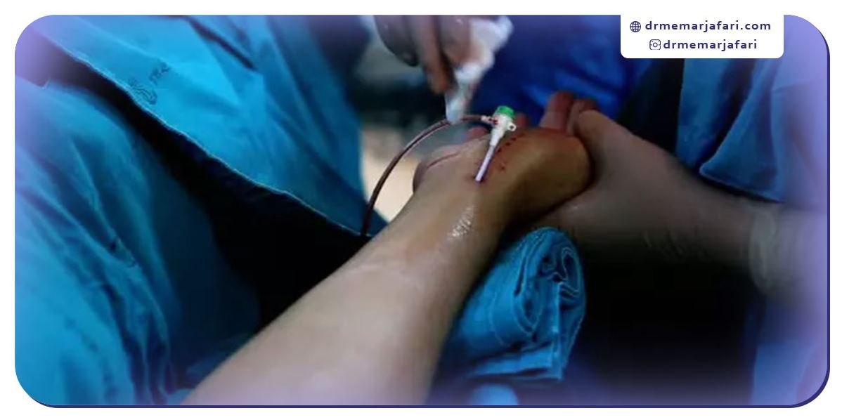 چگونه برای آنژیوگرافی آماده شویم؟