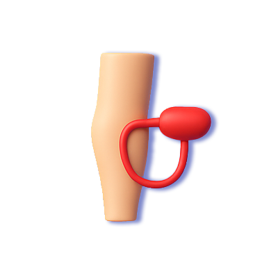 آنژیوپلاستی پا