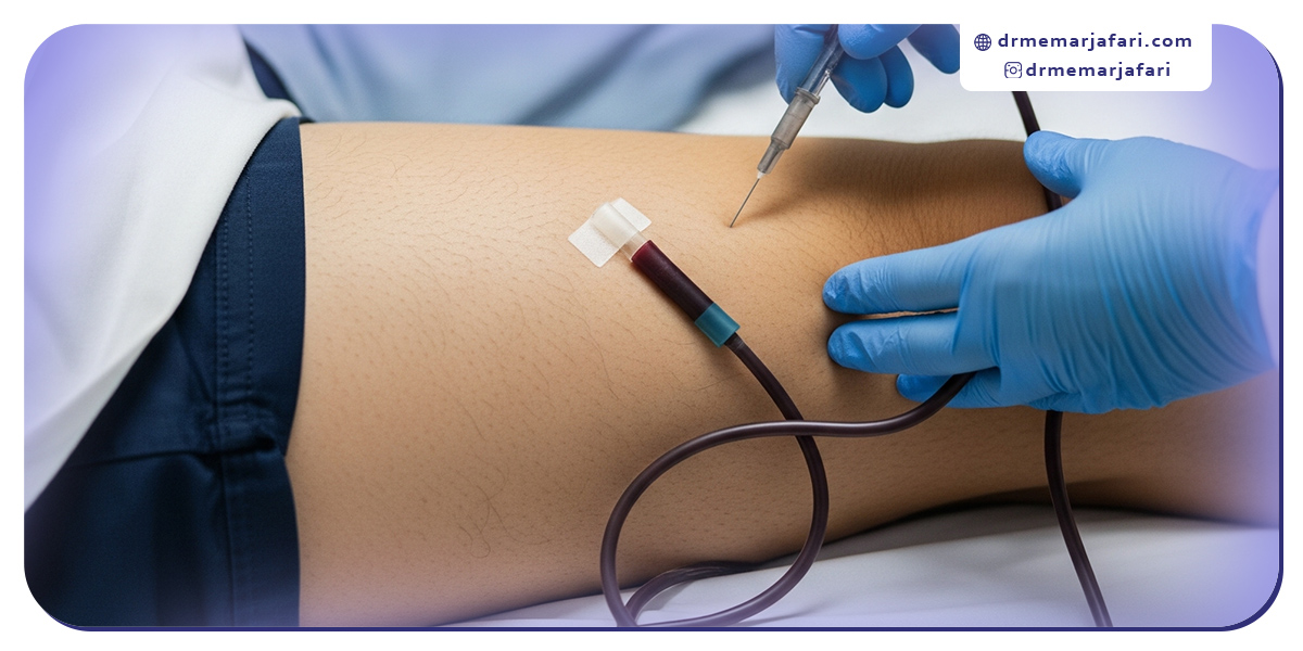 مزایای آنژیوگرافی پای دیابتی