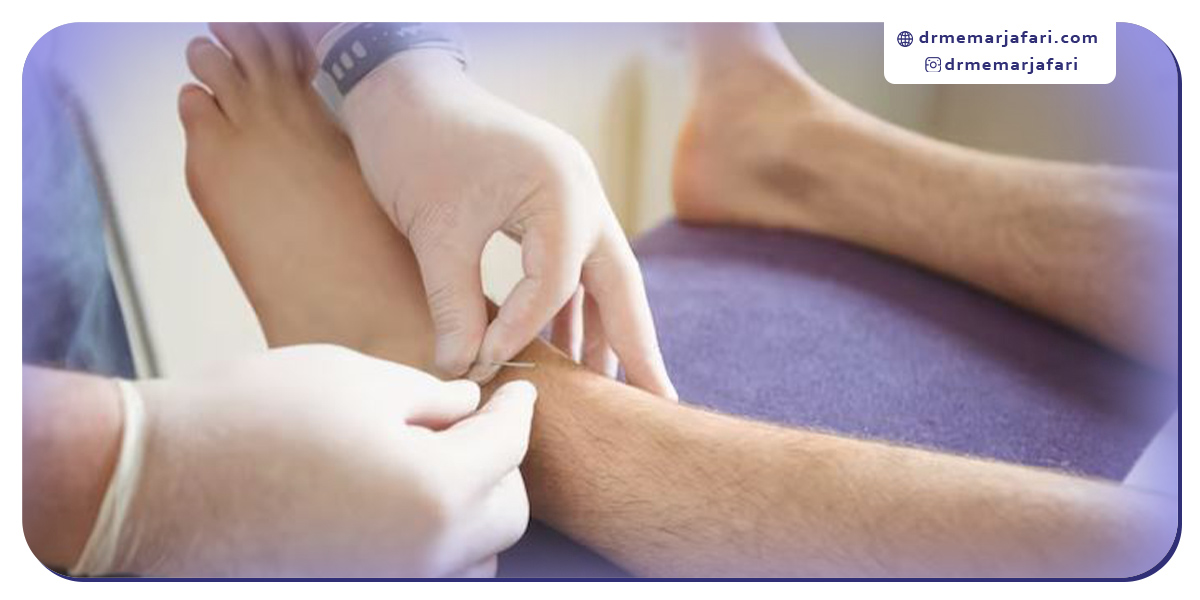 مراقبت های بعد از آنژیوگرافی پای دیابتی